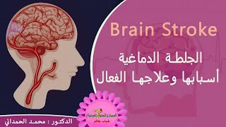 الجلطة الدماغية أسبابها وعلاجها الفعال BRAIN STROKE