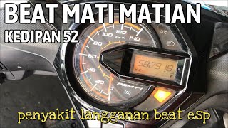 BEAT MATI MATIAN    sensor CKP