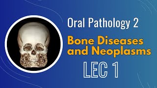 Oral Pathology 2 ; Lec 1 ; Bone Diseases and Neoplasms