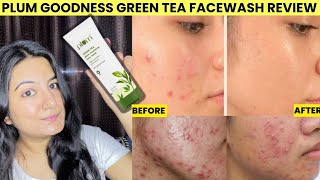 PLUM GREEN TEA FACEWASH REVIEW - Best For Oily & Acne Prone Skin | My Honest Review & Experience 😱❤