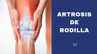 Artrosis de Rodilla - ¿Qué es? - Dr. Isaac Jakter