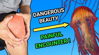 Why and How Do Jellyfish Sting? | Understanding Jellyfish Venom and Defense Mechanisms