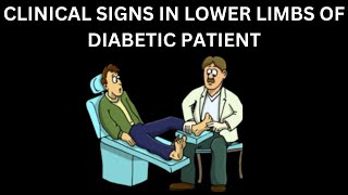 CLINICAL SIGNS IN DIABETIC LOWER LIMBS | EASY WAY TO APPROACH SUCH PATIENTS