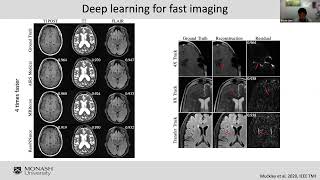 AI in Healthcare Series Workshop: 4 - MRI and PET image reconstruction and clinical applications.