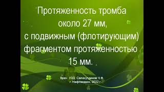 Пристеночный тромб с подвижным фрагментом плечеголовного ствола