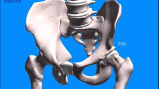 Alterações compensatórias do Impacto Femoroacetabular