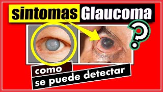 SINTOMAS DE GLAUCOMA como empieza la enfermedad cuales son los sintomas