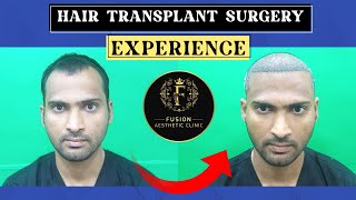 Grade 3 Baldness Transformation | Hyderabad Patient's Hair Transplant Journey to Mumbai