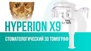 Стоматологический 3D томограф Hyperion X9