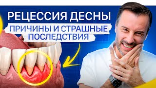 Неочевидная причина рецессии десны. Что делать, если опустилась десна?