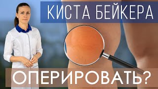 Киста Бейкера. Как лечить кисту Бейкера коленного сустава? Всегда ли нужно оперировать? Упражнения.