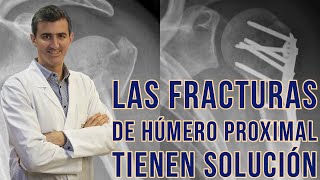 Manejo Óptimo de las Fracturas de Húmero Proximal del Hombro