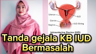 BAHAYA KB IUD BERGESER, Di sebabkan oleh!! #kb #iud