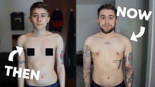 FTM Transgender 5 Year Comparison