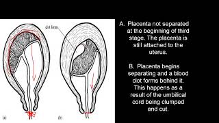 Class 1  PLACENTAL SEPARATION AND EXPULSION 2