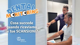 Cosa succede quando riceviamo le tue scansioni? - Dental Monitoring | ADEC Dentista a Milano