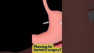 Bariatric surgery with aarogyapay.