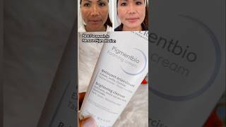 Best Facewash to remove Melasma Hyperpigmentation | Bioderma pigmentbio face Wash Glowing Skincare