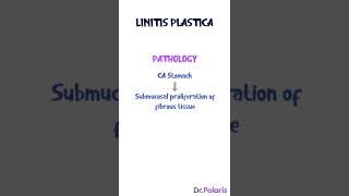 Linitis Plastica - General Surgery