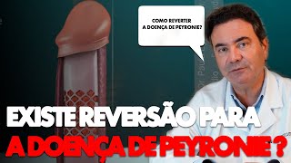 Como reverter a Doença de Peyronie | Dr. Paulo Egydio