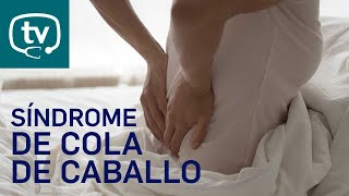 ¿Qué es el síndrome de cola de caballo o cauda equina?