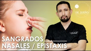 ¿POR QUÉ DAN LOS SANGRADOS NASALES? / EPISTAXIS | DR. SUEÑO JAVIER NAGORE