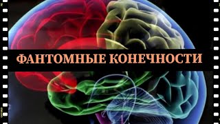 Фантомные Конечности