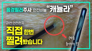 필러남성수술시 캐뉼라를 사용해야되는 이유? 내 몸에 직접 찔러서 설명하는 영상