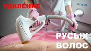 Диодная лазерная эпиляция темных и русых волос!