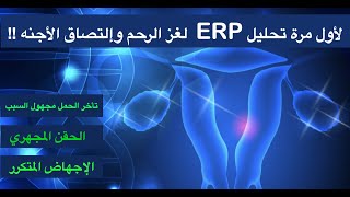 لأول مره تحليل : لغز الرحم وإلتصاق الأجنه: ERP