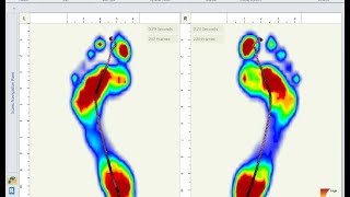 About GaitScan™ Foot Scanning Technology