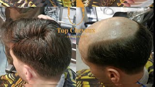 طريقة تركيب الباروكة أو الشبكة الفرنسية بإحترافية  فقط عند top Cheveux 🇲🇦