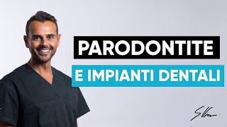 IMPIANTI DENTALI dopo la PARODONTITE: il segreto per una buona durabilità