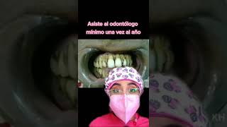 Periodontitis crónica / movilidad dental