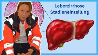 Leberzirrhose bis zum Endstadium (Child-Pugh-Kriterien)