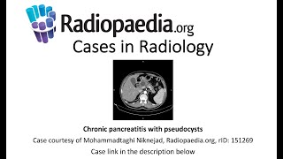 Chronic pancreatitis with pseudocysts (Radiopaedia.org) Cases in Radiology