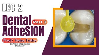 Operative 4 ; Lec 2 ; Dental Adhesion Part 2