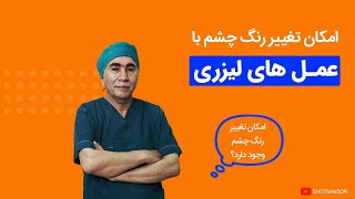 امکان تغییر رنگ چشم | آیا با عمل‌های لیزری امکان رنگ تغییر چشم وجود دارد ؟!