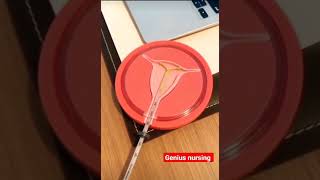 Copper T placement | iud insertion #shorts