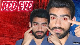 Conjunctivitis in urdu/ hindi || Pink eye || Red eye