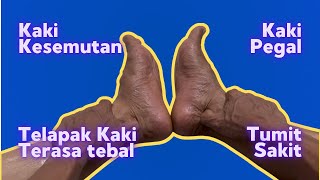 Teknik Pijat Refleksi Kaki Mengatasi Kesemutan, Tumit Sakit, Pegal | Telapak Kaki Lebih Enteng