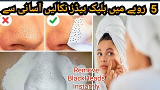 Homemade Black Heads Remover | Instantly Remove BlackHeads @cookandhacks