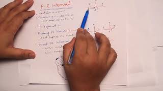 ECG 2 : Waves and intervals ( P wave PR interval)