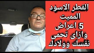 اعراض مرض الفطر الاسود المميت سبب وفاه الفنان سمير غانم وكيف تحمى نفسك وولادك ؟