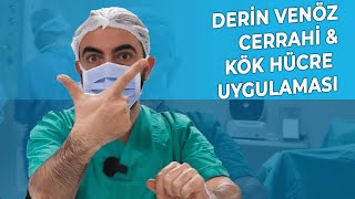 Derin Venöz Cerrahi | Kök Hücre Uygulaması #ameliyat