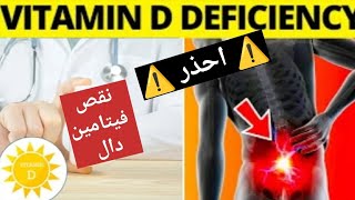 ⚠️ 12 علامة خطيرة تدل علي نقص فيتامين (د) | Vit D | الحلقة #9