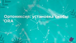 Ортониксия: Установка скобы ORA