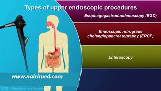 Endoscopic procedure