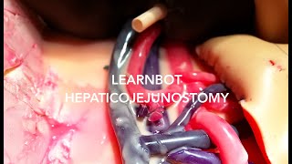 Robotic Surgery - Interrupted Hepaticojejunostomy (LEARNBOT Instruction Video)