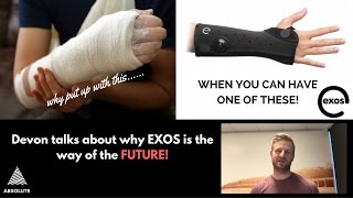 Why EXOS Bracing is the FUTURE and Plaster Casting is NOT!